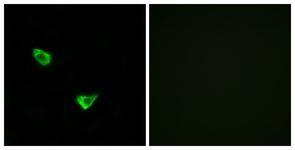 Anti-CHSY2 antibody used in ICC/IF. GTX87921