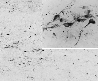 Anti-AGRP / Agouti-related protein antibody, C-term used in IHC (Frozen sections). GTX89559