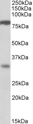 Anti-CLCA1 antibody, Internal used in Western blot. GTX89537