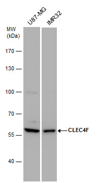 Anti-CLEC4F antibody used in Western blot. GTX120564