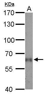 Anti-AGXT2L1 antibody used in Western blot. GTX105356