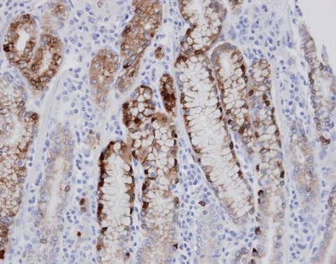 Anti-AGXT2L1 antibody used in IHC (Formalin-fixed paraffin-embedded sections). GTX105356