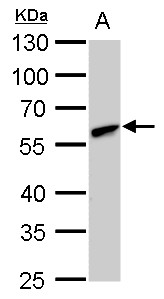 Anti-CLN3 antibody used in Western blot. GTX129457