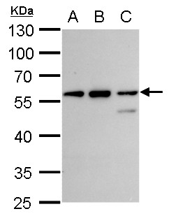 Anti-CLN3 antibody used in Western blot. GTX129457