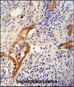 Anti-CLPX antibody used in Immunohistochemistry. GTX53477