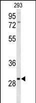 Anti-CLRN3 antibody, C-term used in Western blot. GTX80544