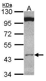 Anti-CLUAP1 antibody used in Western blot. GTX106897