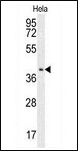 Anti-CMPK2 antibody used in Western blot. GTX53527