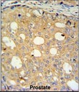 Anti-CMPK2 antibody used in Immunohistochemistry. GTX53527