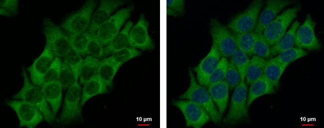 Anti-AHCYL2 antibody [N3C3] used in ICC/IF. GTX112212