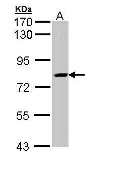 Anti-AHCYL2 antibody [N3C3] used in Western blot. GTX112212