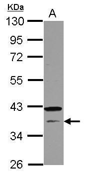 Anti-CNTD1 antibody [N2C3] used in Western blot. GTX121398