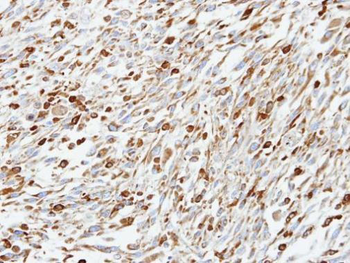 Anti-CoCoA antibody [N2C2], Internal used in IHC (Formalin-fixed paraffin-embedded sections). GTX105118