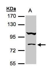 Anti-CoCoA antibody [N2C2], Internal used in Western blot. GTX105118