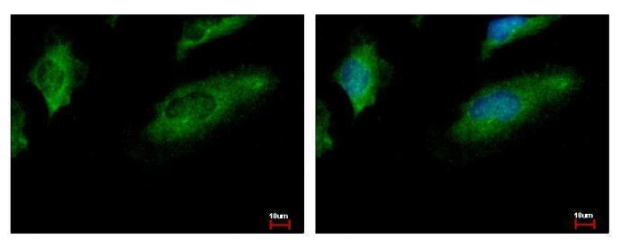 Anti-CoCoA antibody [N2C2], Internal used in ICC/IF. GTX105118