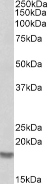 Anti-Cofilin 2 antibody, C-term used in Western blot. GTX89482
