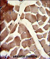 Anti-COG4 antibody, C-term used in IHC (Formalin-fixed paraffin-embedded sections). GTX81455