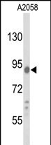 Anti-COG4 antibody, C-term used in Western blot. GTX81455