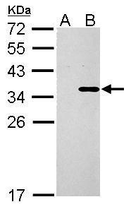 Anti-COL11A2 antibody used in Western blot. GTX128011