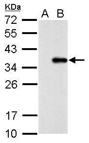 Anti-COL11A2 antibody used in Western blot. GTX128012