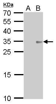 Anti-COL11A2 antibody [GT212] used in Western blot. GTX629481