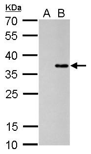 Anti-COL11A2 antibody [GT473] used in Western blot. GTX629740