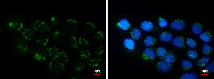 Anti-COL11A2 antibody [GT473] used in ICC/IF. GTX629740