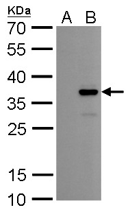 Anti-COL11A2 antibody [GT6410] used in Western blot. GTX629739