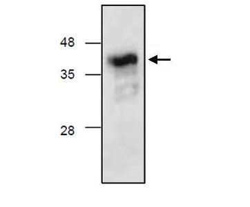 Anti-Complement Factor D antibody used in Western blot. GTX16212
