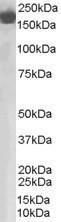 Anti-Complement factor H antibody, Internal used in Western blot. GTX89512