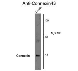 Anti-Connexin 43 antibody used in Western blot. GTX82718