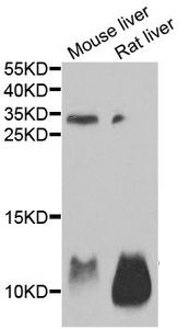Anti-AHSP antibody used in Western blot. GTX30035