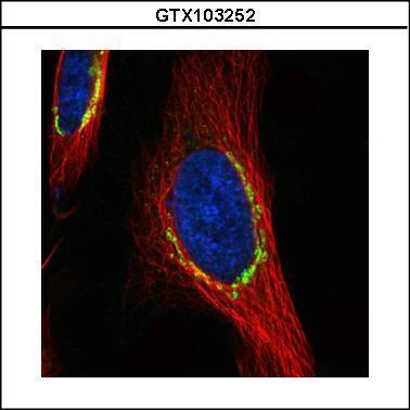 Anti-COPD antibody used in ICC/IF. GTX103252