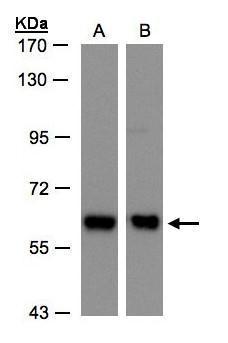 Anti-COPD antibody used in Western blot. GTX103252