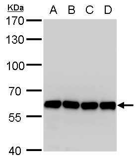 Anti-COPD antibody [GT1318] used in Western blot. GTX630562
