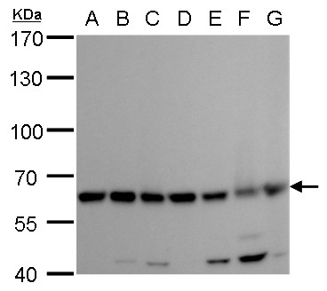 Anti-COPD antibody [GT1318] used in Western blot. GTX630562