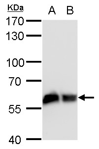 Anti-COPD antibody [GT1318] used in Western blot. GTX630562