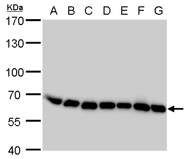 Anti-COPD antibody [GT189] used in Western blot. GTX630561