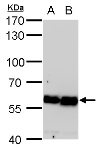 Anti-COPD antibody [GT189] used in Western blot. GTX630561