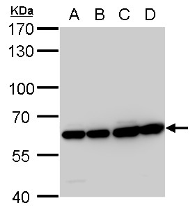 Anti-COPD antibody [GT189] used in Western blot. GTX630561