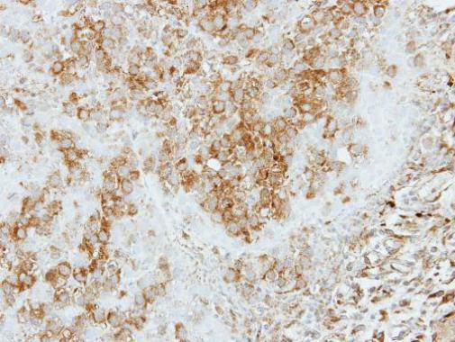 Anti-COPS4 antibody [N1C1] used in IHC (Formalin-fixed paraffin-embedded sections). GTX118165