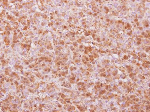 Anti-COPS4 antibody [N3C3] used in IHC (Formalin-fixed paraffin-embedded sections). GTX117852