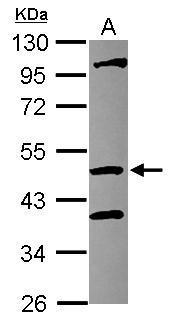 Anti-COPS4 antibody [N3C3] used in Western blot. GTX117852
