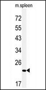 Anti-COPZ2 antibody used in Western blot. GTX53526