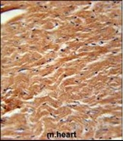 Anti-COPZ2 antibody used in Immunohistochemistry. GTX53526