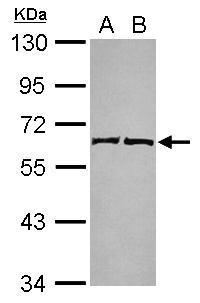 Anti-COQ6 antibody [N1C1] used in Western blot. GTX120499