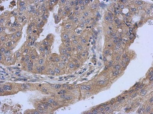 Anti-COQ6 antibody [N1C1] used in IHC (Formalin-fixed paraffin-embedded sections). GTX120499