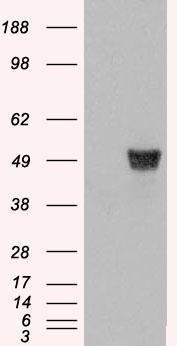 Anti-Coronin 1 / TACO antibody, C-term used in Western blot. GTX89757