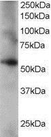 Anti-Coronin 3 / coronin 1C antibody, C-term used in Western blot. GTX15719