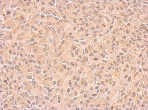 Anti-COX1 antibody used in IHC (Formalin-fixed paraffin-embedded sections). GTX113259